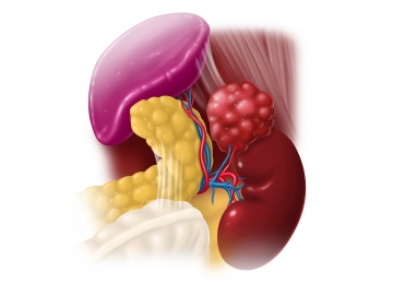 Exposing the superior left retroperitoneum