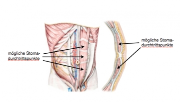 Anatomy of the anterior abdominal wall