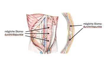 Anatomy of the Anterior Abdominal Wall