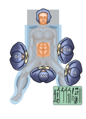 Configuración del quirófano
