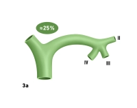 123_LAV_03_a_Gallenwege