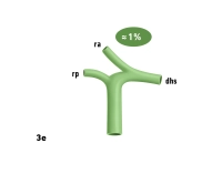 165_LAV_03_e_Gallenwege