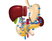 173_PM1_Lymphadenektomie_Heiss