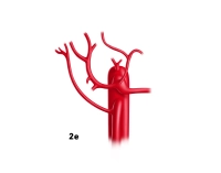 77_LAV_02_e_Leberarterie