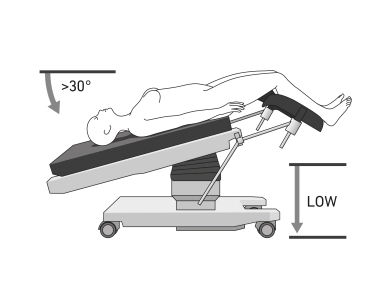 diagnostic laparoscopy for adhesion zone, lavage cytology, biopsy sampling, second look operation diagnostic laparoscopy for adhesion zone, lavage cytology, biopsy sampling, second look operation