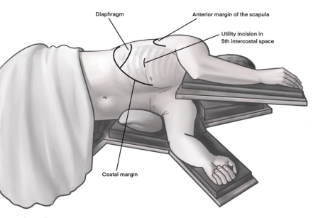 401_Liegender_Patient 401_Liegender_Patient