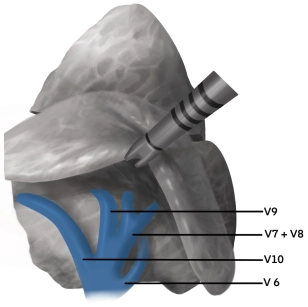 412-Anatomie-Vene 412-Anatomie-Vene